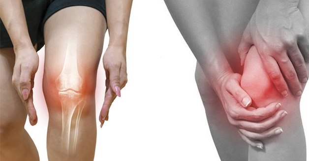 nguyên nhân viêm khớp cấp