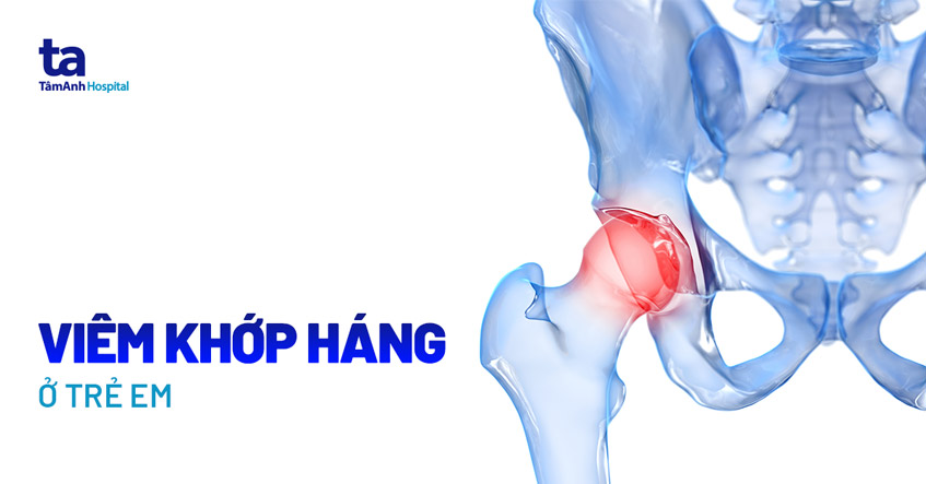 Triệu chứng viêm khớp háng ở trẻ em