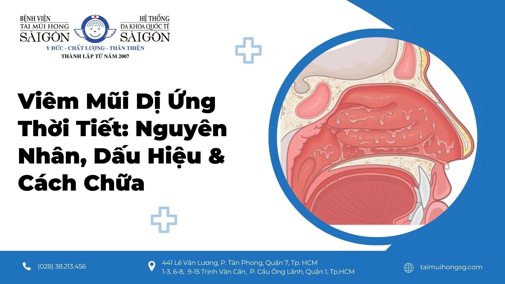 Viêm mũi dị ứng theo mùa