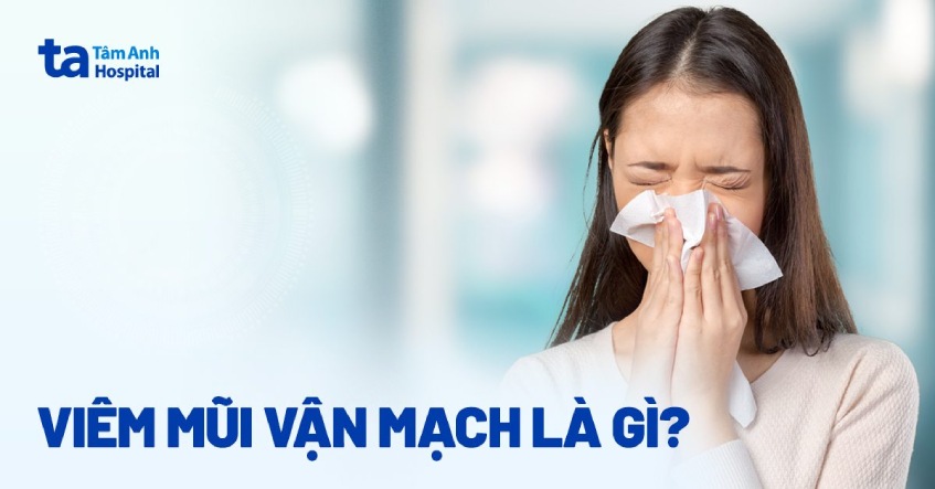 Viêm Mũi Vận Mạch Là Gì? Triệu Chứng, Nguyên Nhân và Cách Điều Trị Hiệu Quả 8 Nguyên nhân viêm mũi vận mạch