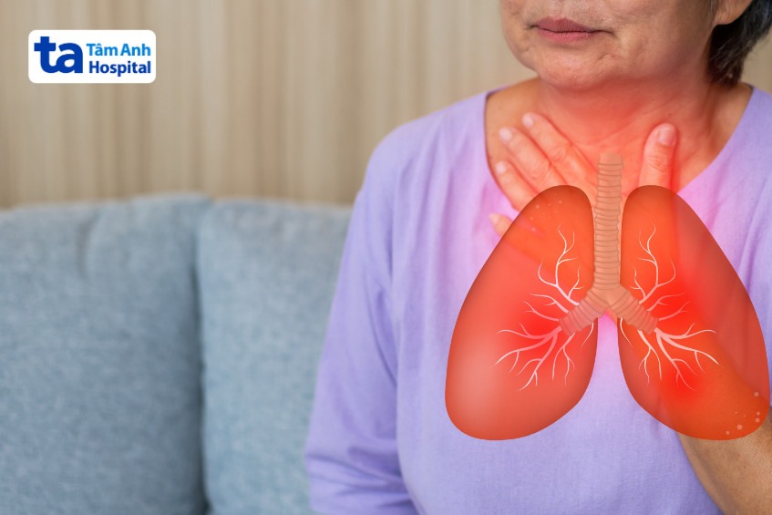 Viêm phổi mô kẽ không đặc hiệu triệu chứng