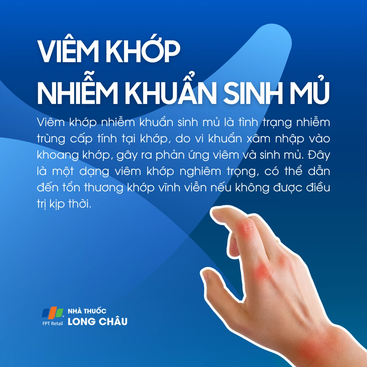 Viêm khớp sinh mủ là gì