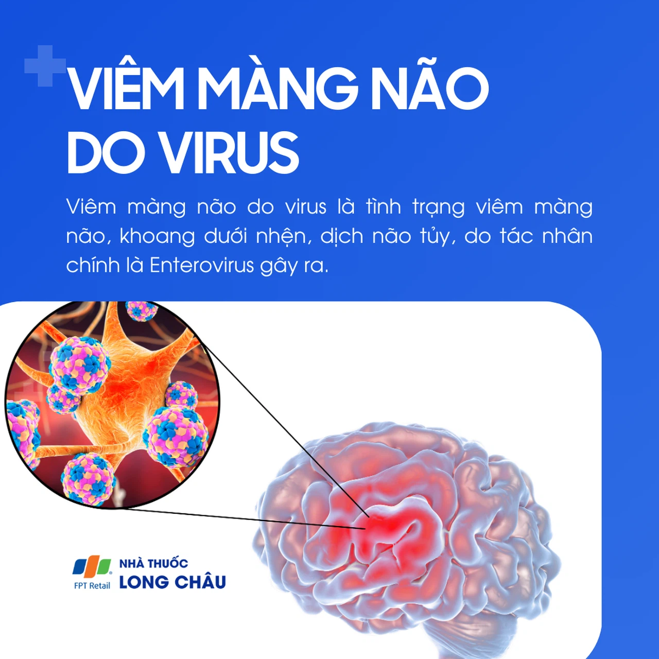 Hình ảnh viêm màng não do virus