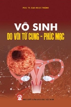 Vô sinh do vòi trứng và phúc mạc