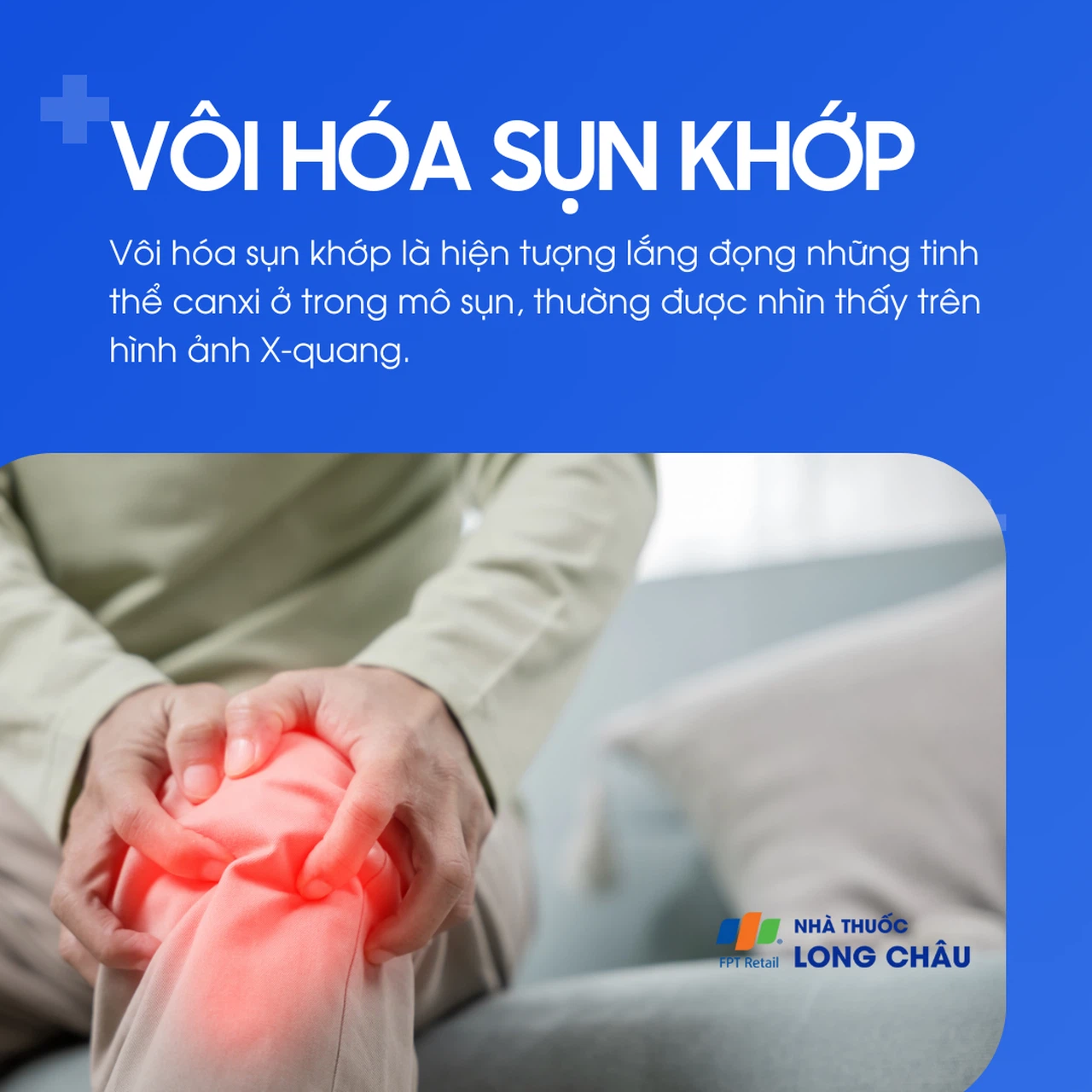 Triệu chứng sưng đau do vôi hóa sụn khớp