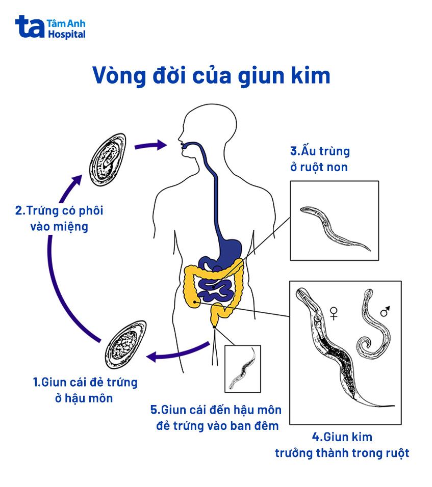 chu trình phát triển của giun kim