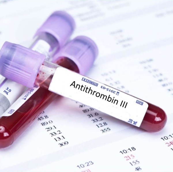 Xét nghiệm Antithrombin III