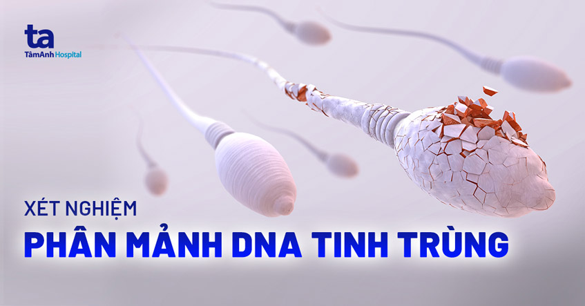 Xét nghiệm phân mảnh DNA tinh trùng