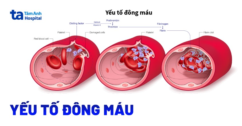 Thiếu yếu tố đông máu II (Prothrombin): Nguyên nhân, triệu chứng và điều trị 7 Hình minh họa các yếu tố đông máu