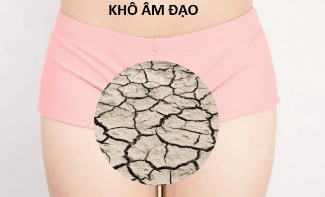 Điều trị khô âm đạo