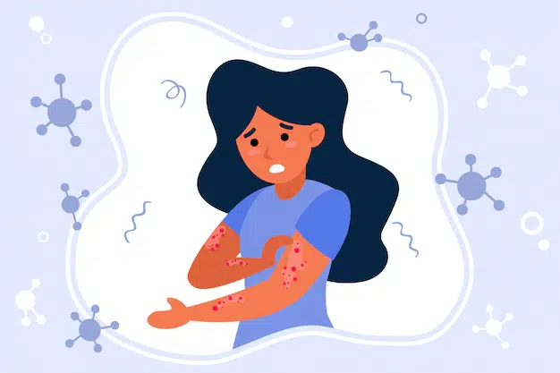 Phản ứng dị ứng nghiêm trọng (Sốc phản vệ): Nguyên nhân, Dấu hiệu và Cách Cấp Cứu Kịp Thời 8 Các mức độ sốc phản vệ