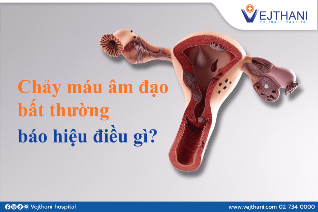 Nguyên nhân chảy máu âm đạo