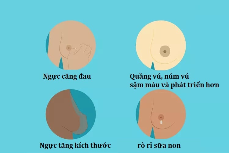 Dấu hiệu thay đổi vú bất thường