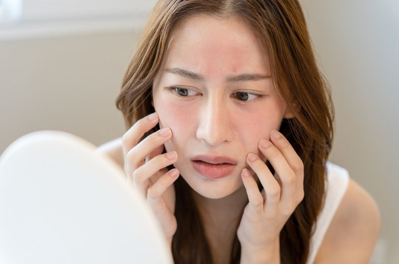Da mặt nóng bừng và đỏ
