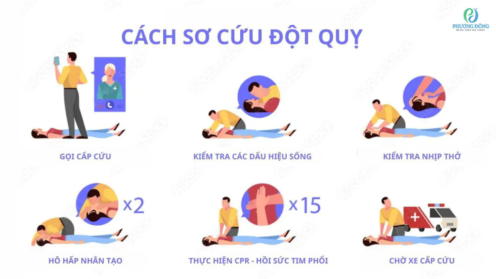 Đột quỵ: Dấu hiệu, phòng ngừa và cách xử lý cấp cứu 4 image 2
