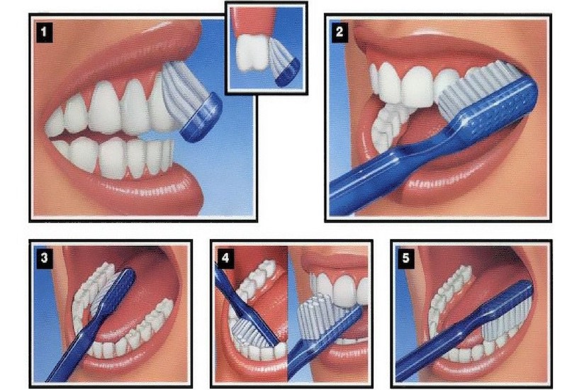 Hướng dẫn từng bước chải răng đúng cách