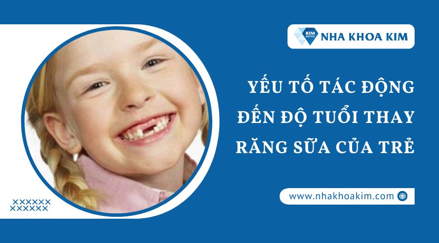 Yếu tố ảnh hưởng đến thay răng