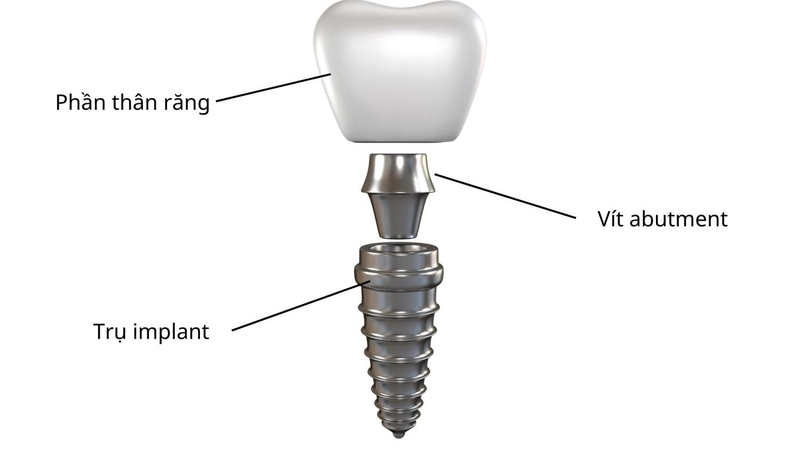 Vít abutment cơ bản