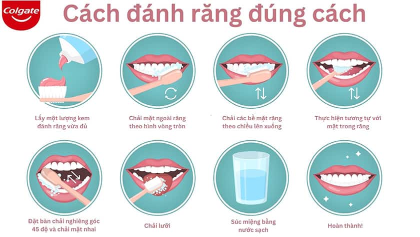 Cách chải răng đúng cách minh họa
