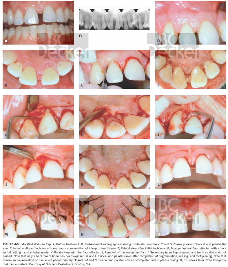 Chuẩn bị trước mổ