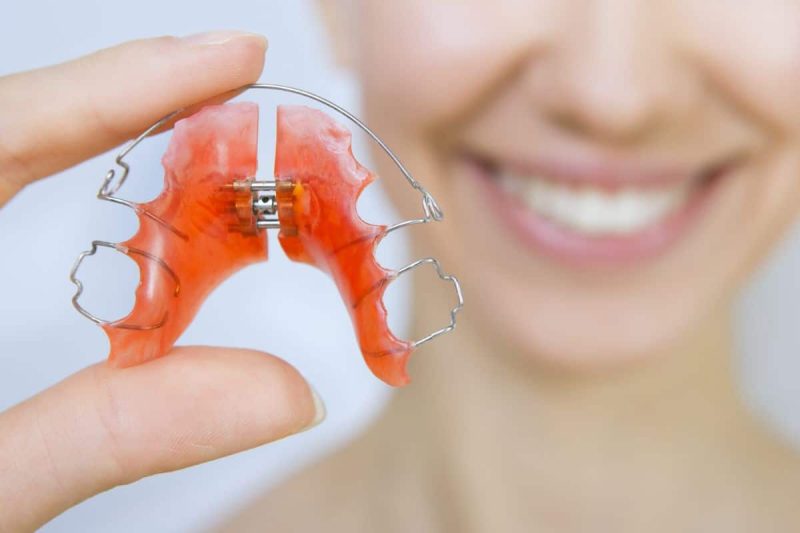 Khí cụ nong hàm tháo lắp