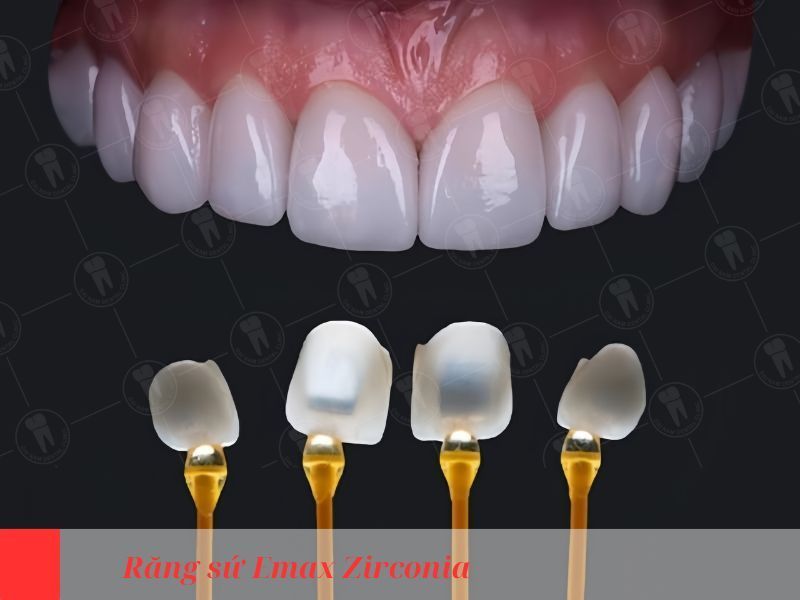 răng sứ emax