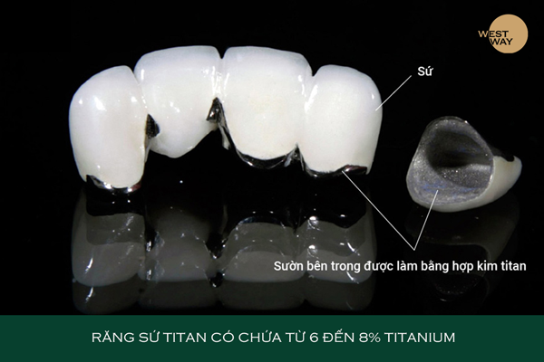 Cấu tạo răng sứ titan