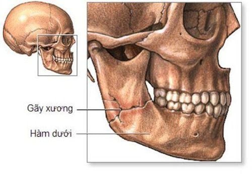 Tập vận động xương hàm