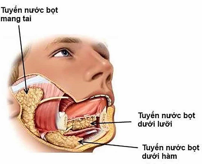 Điều trị sỏi tuyến nước bọt