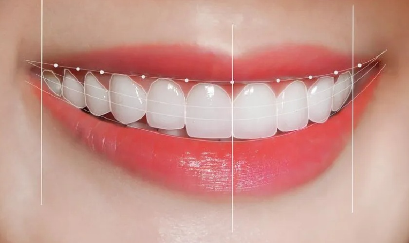 Bác sĩ tư vấn Smile Design