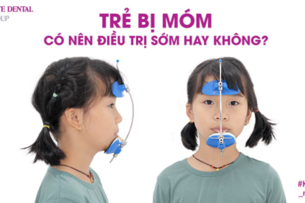 Trẻ mang khí cụ Face Mask